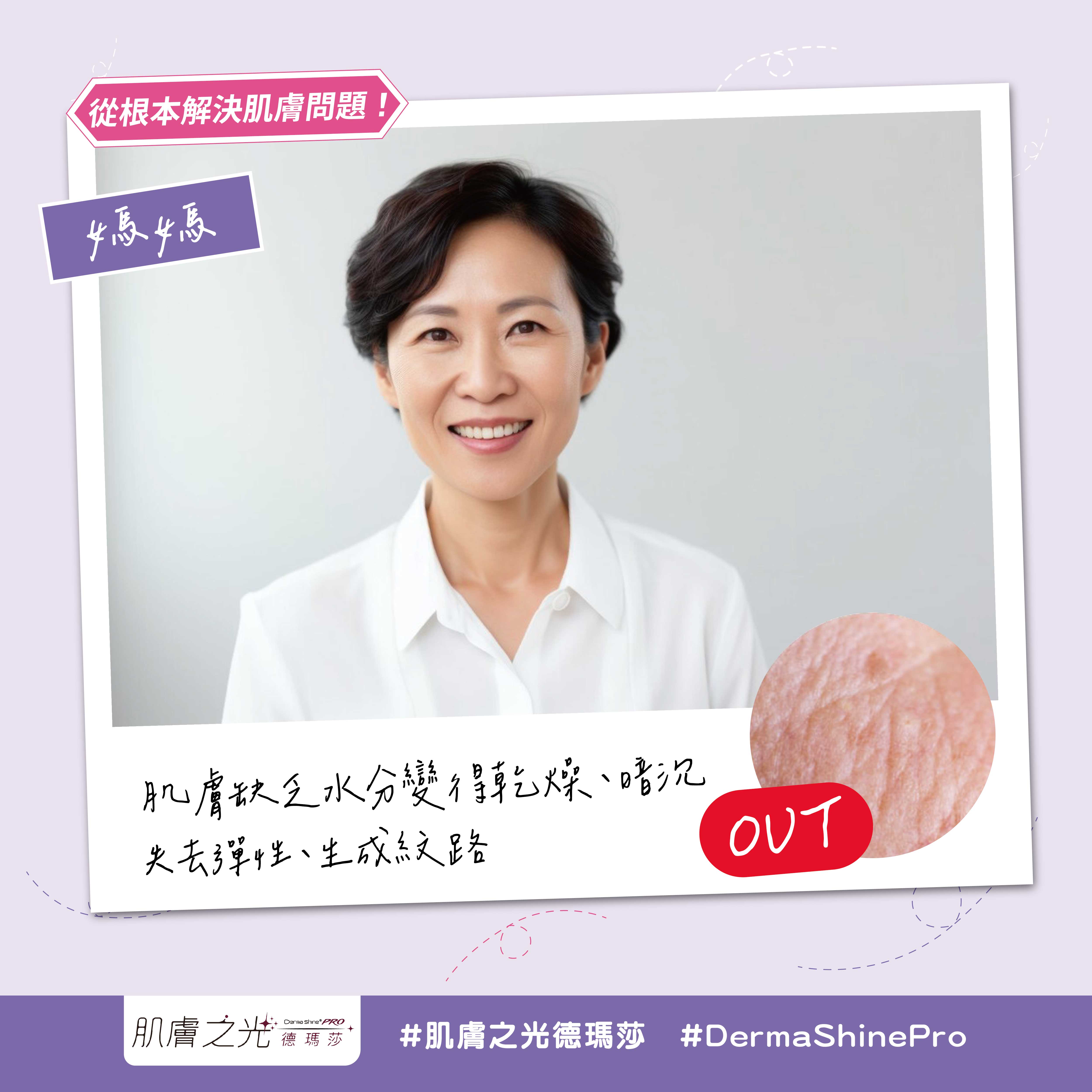 Dermashine 德瑪莎肌膚之光