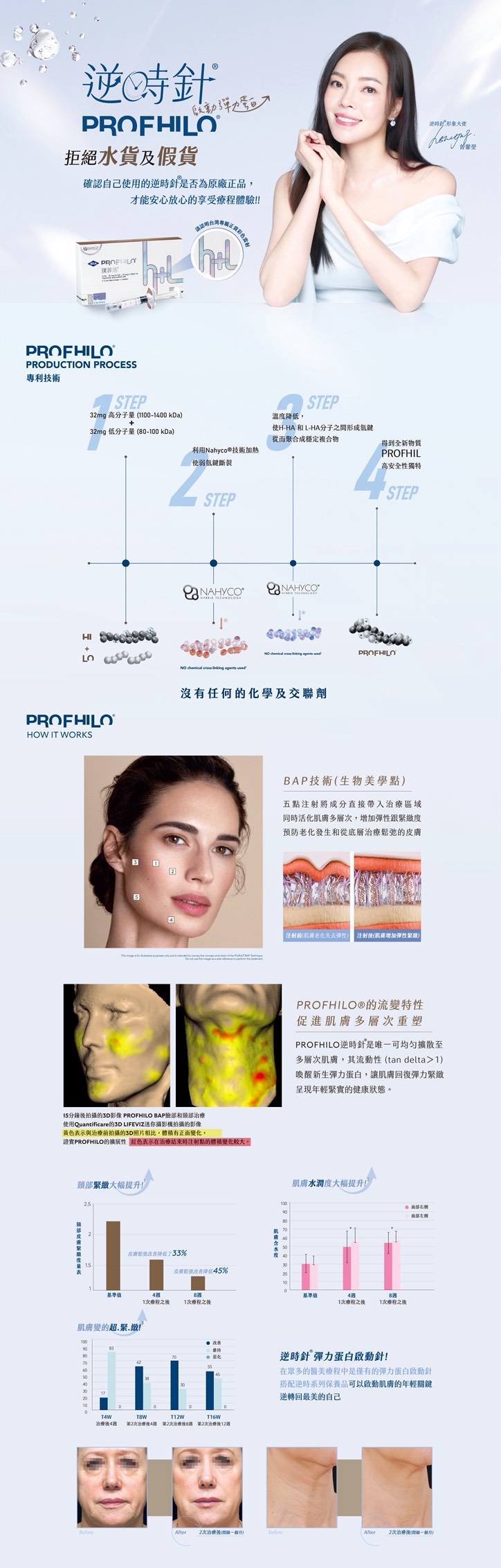 全方位提升 Profhilo逆時針