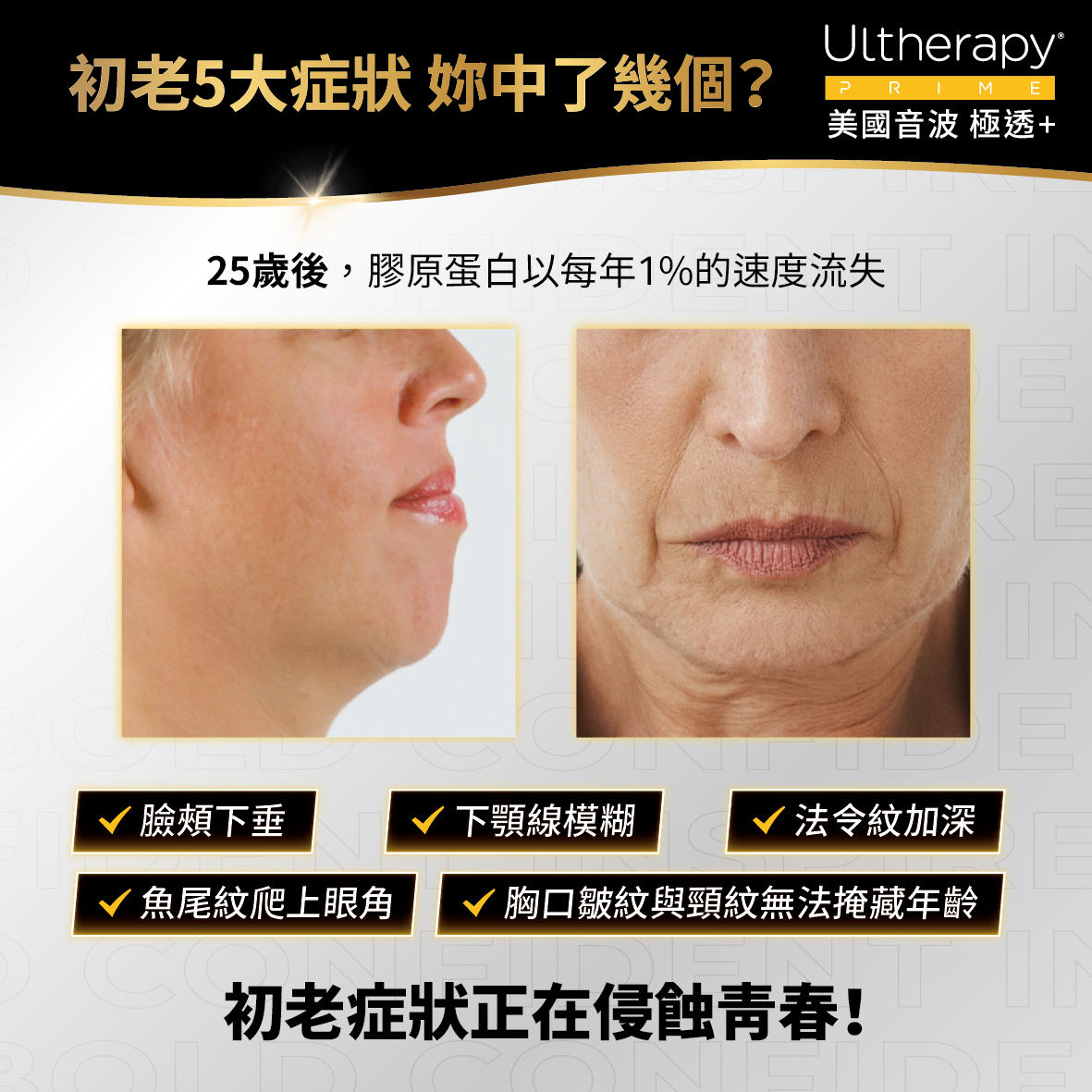 UItherapy PRIME 美國音波二代-淨透+