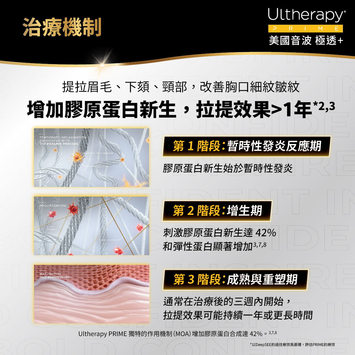 UItherapy PRIME 美國音波二代-淨透+