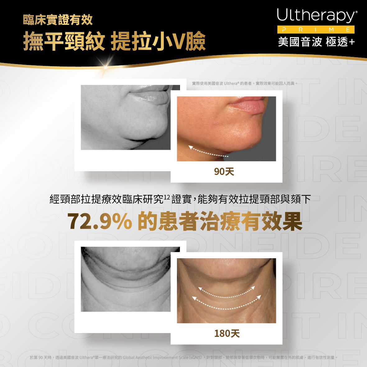 UItherapy PRIME 美國音波二代-淨透+
